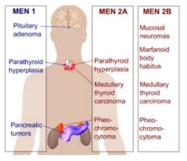 18. MEN Syndromes Flashcards | Quizlet