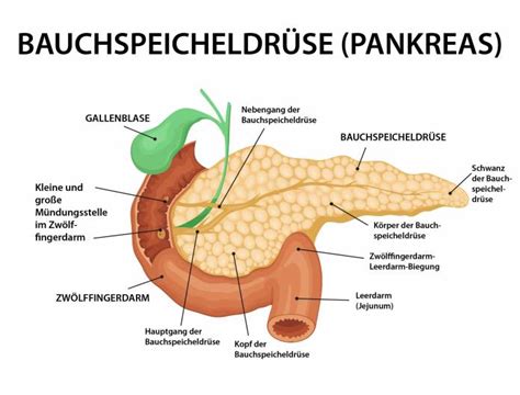 Bauchspeicheldr Senentz Ndung Pankreatitis