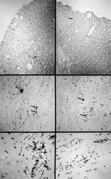 Demyelination In The Spinal Cord Of B M Dr Nontransgenic A