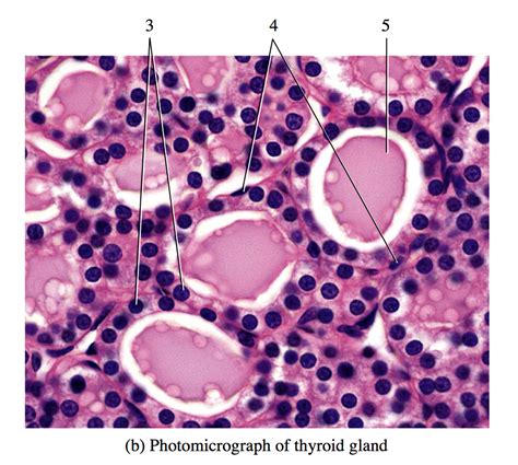 Thyroid Gland Cells Labeled