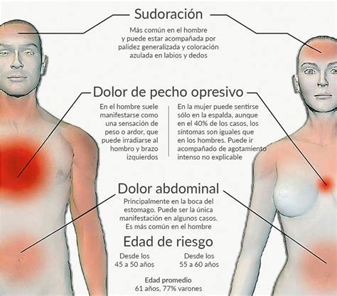 Infartos De Miocardio En Hombres Y Mujeres La Cruz Azul