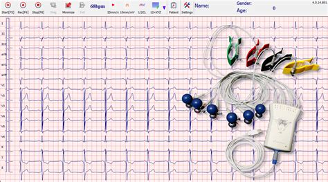 Lead Ambulatory Handheld Ecg Machine For Vales Hills Grey Ecg