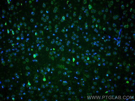 Park2parkin Antibody Cl488 14060 Proteintech 武汉三鹰生物技术有限公司