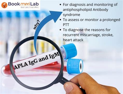 APLA Test IgG And IgM Purpose Price Procedure Results 2025