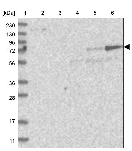 Rabbit Polyclonal Anti Add2 Antibody Buy For Research Highly