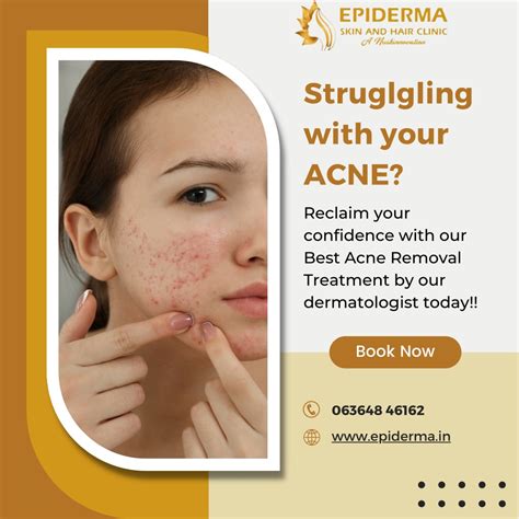 Ppt Struggling With Your Acne Best Skin Clinic In Jayanagar Epiderma Clinic Powerpoint