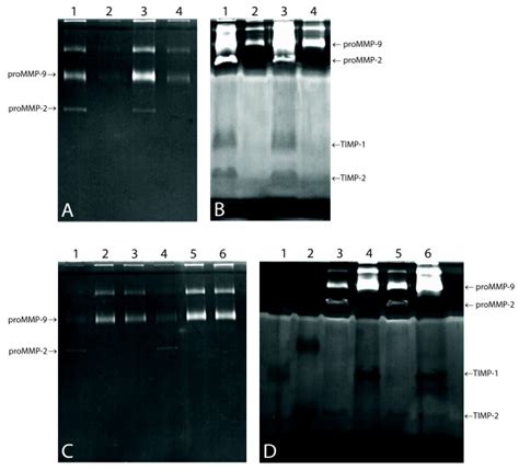 Mmp And Timp Location A Gelatin Zymography 10 Gel And B Download Scientific Diagram