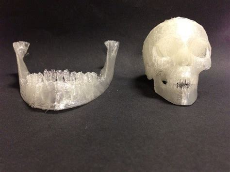 Using A 3d Bioprinter To Create Bone Allevi