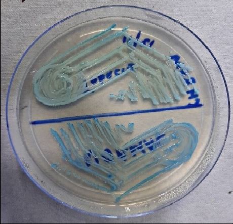 candida albicans  candida tropicalis  chromagar