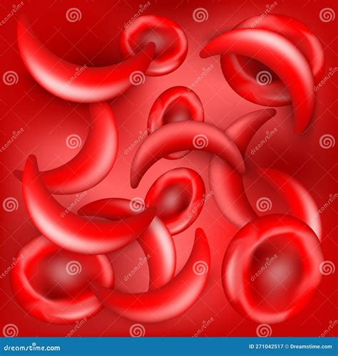 Sickle Cell Disease Scd Red Background Anemia Or Anaemia Stock