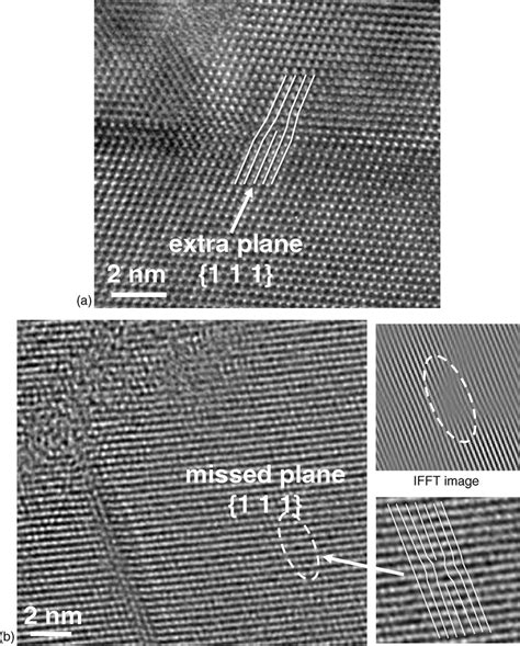 Ultra High Voltage Mv Tem Images Of Dislocations A Threading