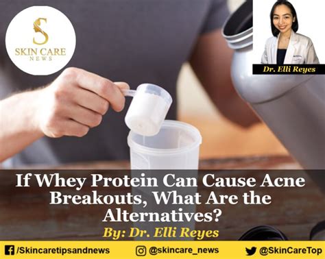 If Whey Protein Can Cause Acne Breakouts What Are The Alternatives