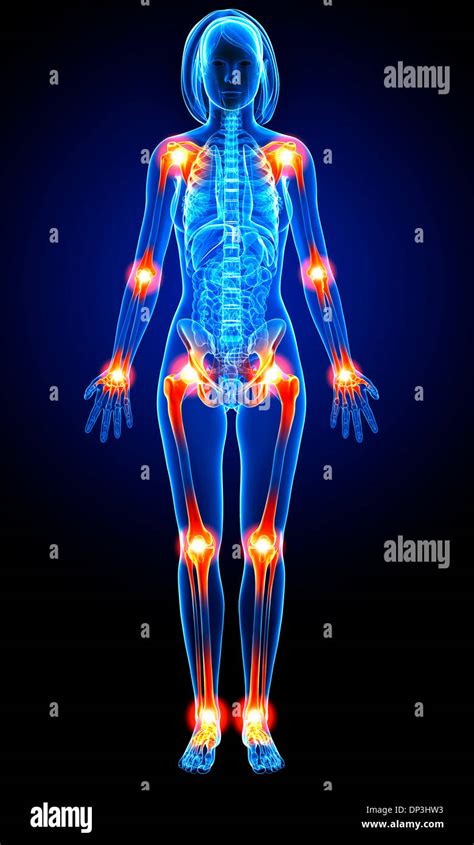 Joint Pain Hi Res Stock Photography And Images Alamy