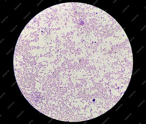 Premium Photo Staphylococcus Aureus Bacteria Colonie Gram Stain