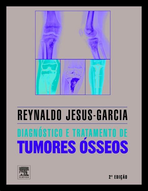 Pdf Jesus Garcia Diagn Stico E Tratamento De Tumores Sseos E