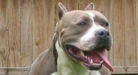 Roma Donna Azzannata Da Un Pitbull Il Cane Le Stacca Tre Dita Della