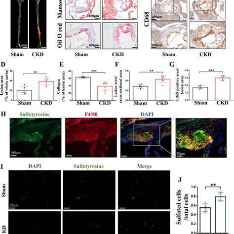 Clinical Relevance Between Tyrosine Sulfation And Atherosclerosis In