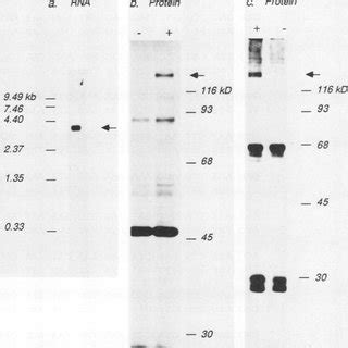 A Northern Blot Analysis Of Total Rna Prepared From Hela Cells And