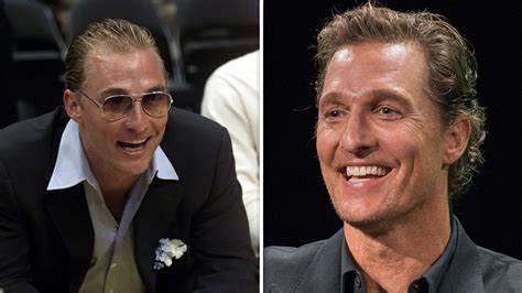 Matthew McConaughey Says Surgeon Lied About Hair Transplant