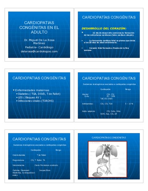 Pdf Cardiopatías Congénitas En El Adulto