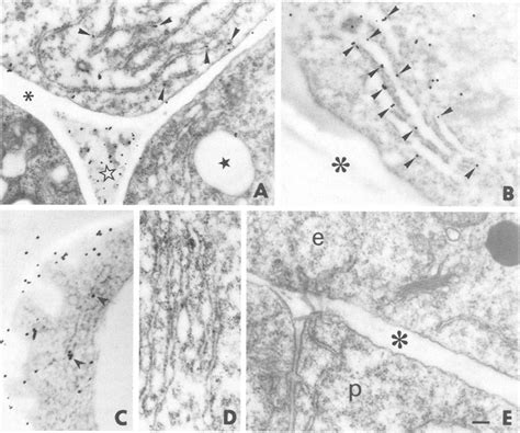 Immunogold Cytochemistry Of Lm2 And Jim13 Agp Epitopes Associated With