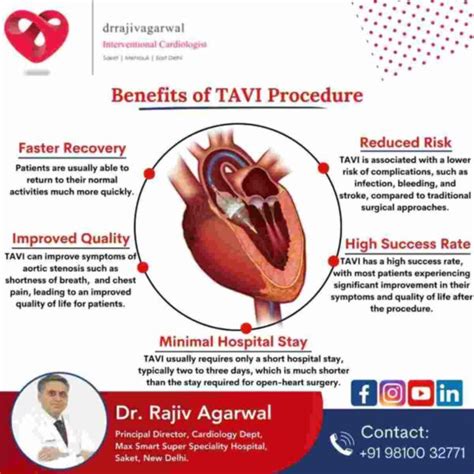 Tavi A New Boon For Heart Valve Problems Explained By Dr Rajiv