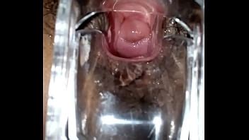 Speculum Videos XVIDEOS