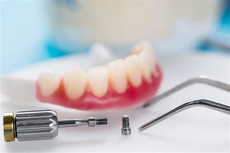 Implant Overdentures Transform Your Smile Smile Center