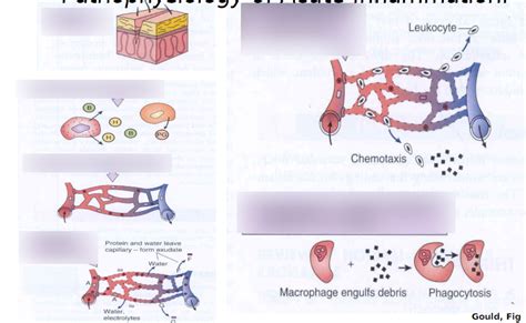 inflammation diagram diagram quizlet