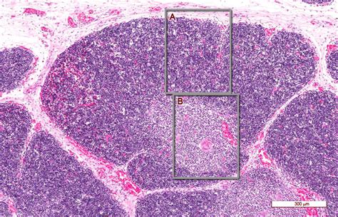 Timo Histologia