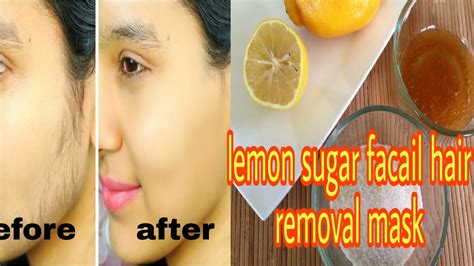 Lemon Juice And Sugar Home Remedy For Facial Hair Removal S A BEAUTY