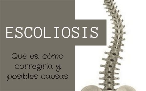 La Escoliosis Qu Es C Mo Mejorarla Y Posibles Causas