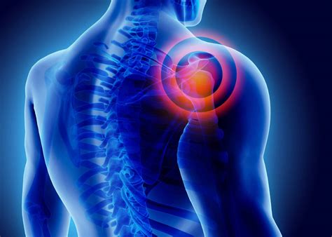 Shoulder Pain Treatment in NJ | Northeast Spine and Sports Medicine