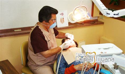 Servicio Dental Tijuana Clinica Dental