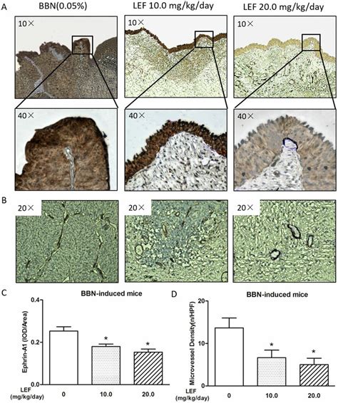 Lef Suppresses The Expression Of Ephrin A And Microvessel Density In