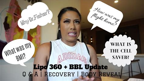 Lipo Bbl Journey Bbl Update Bbl Q A Post Surgery Body