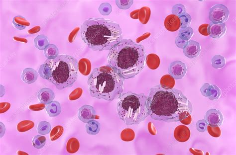 Auer Rods In Acute Promyelocytic Leukaemia Illustration Stock Image