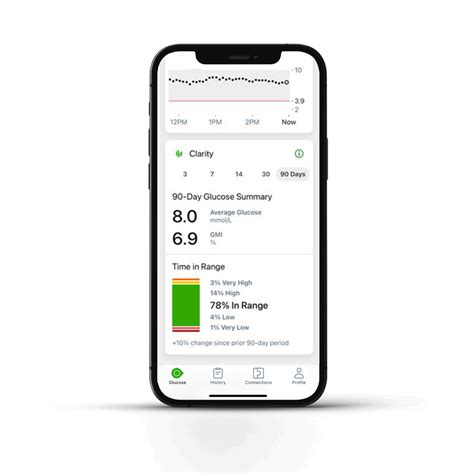 Dexcom G7