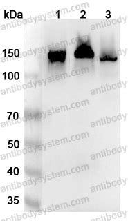 buy anti human cdcdh polyclonal antibody