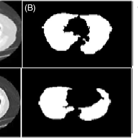 A Test Image And B Result Of Bilateral Filtered Image Download Scientific Diagram