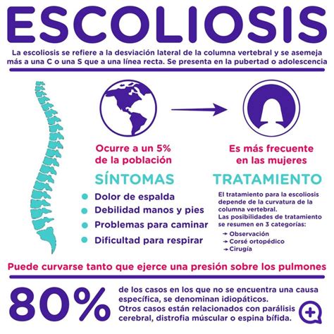 Qué es la escoliosis lumbar