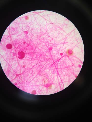 Lab Practical Fungi Flashcards Quizlet