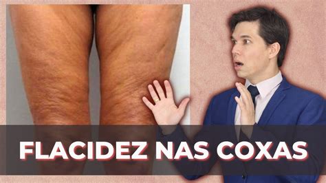 Flacidez Das Coxas Acabe A Flacidez Do Corpo Youtube