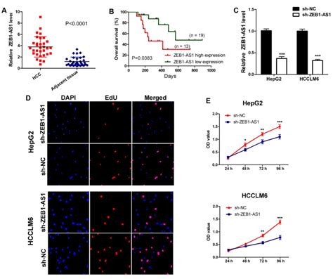 Lncrna Zeb1‑as1 Reduces Liver Cancer Cell Proliferation By Targeting