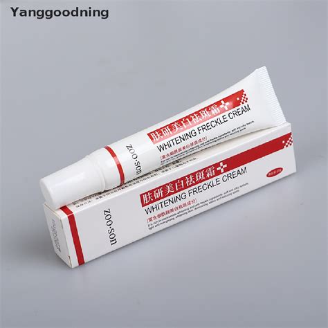 Yanggoodning Creme Removedor De Manchas Pigmenta O De Melasma Acne