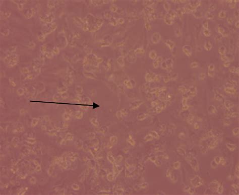 Cytopathic effect on 72 hpi; almost entire dissociation of cell... | Download Scientific Diagram