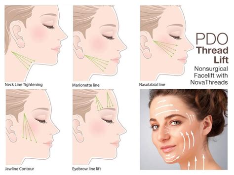 Non Invasive Face Lift Tampa