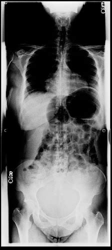 Exam 4 Radiographs Flashcards Quizlet