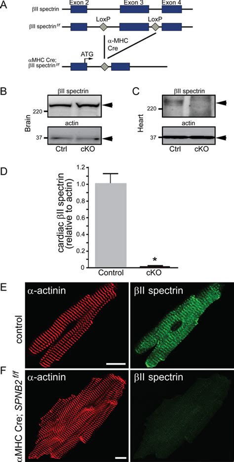 Dysfunction In The Ii Spectrin Dependent Cytoskeleton Underlies Human