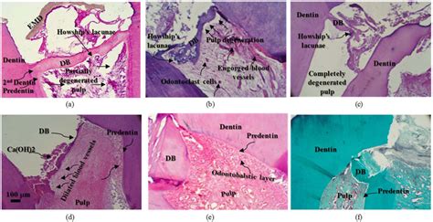 Light microscopy images of coronal sections: Emdogain gel–treated... | Download Scientific Diagram